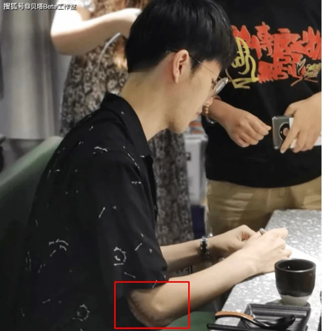 Thery's very serious hand injury